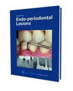 Hardcover Endo-Periodontal Lesions Book