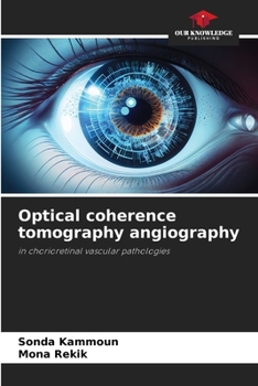 Paperback Optical coherence tomography angiography Book