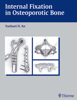 Hardcover Internal Fixation in Osteoporotic Bone Book