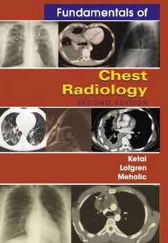 Paperback Fundamentals of Chest Radiology Book