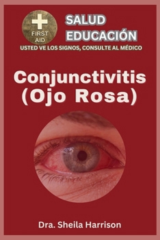 Ojo rosa (conjuntivitis): Tipos, Síntomas, Causas, Diagnóstico, Tratamiento, Medicamentos, Prevención y Control, Manejo (ESTANTE DE EDUCACIÓN PARA LA ... SIGNOS, USTED VE AL MÉDICO) (Spanish Edition)
