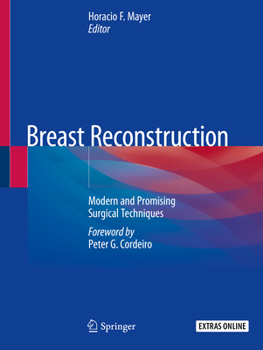 Paperback Breast Reconstruction: Modern and Promising Surgical Techniques Book