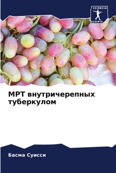 Paperback МРТ внутричерепных тубе& [Russian] Book