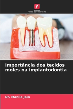 Importância dos tecidos moles na implantodontia (Portuguese Edition)