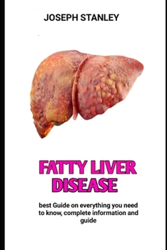 Paperback Fatty Liver Disease: Fatty Liver Disease Associated with Nonalcoholic Drinking Book