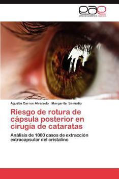 Paperback Riesgo de Rotura de Capsula Posterior En Cirugia de Cataratas [Spanish] Book