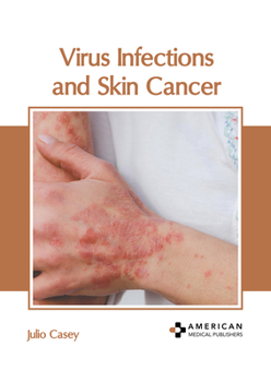 Hardcover Virus Infections and Skin Cancer Book
