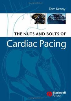 Paperback The Nuts and Bolts of Cardiac Pacing Book