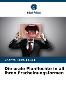 Paperback Die orale Planflechte in all ihren Erscheinungsformen [German] Book