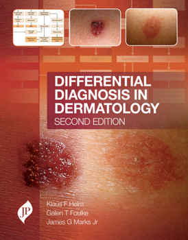 Hardcover Differential Diagnosis in Dermatology: Second Edition Book