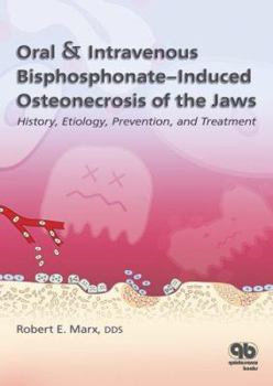 Paperback Oral & Intravenous Bisphosphonate-Induced Osteonecrosis of the Jaws: History, Etiology, Prevention, and Treatment Book