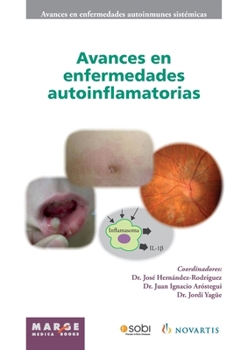 Avances en enfermedades autoinflamatorias (Spanish Edition)
