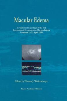 Paperback Macular Edema: Conference Proceedings of the 2nd International Symposium on Macular Edema, Lausanne, 23-25 April 1998 Book