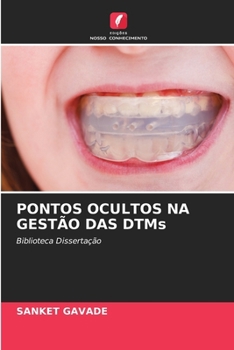 Paperback PONTOS OCULTOS NA GESTÃO DAS DTMs [Portuguese] Book