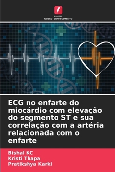 ECG no enfarte do miocárdio com elevação do segmento ST e sua correlação com a artéria relacionada com o enfarte (Portuguese Edition)
