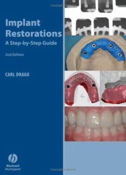 Hardcover Implant Restorations: A Step-By-Step Guide Book