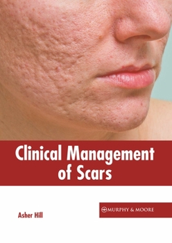 Hardcover Clinical Management of Scars Book