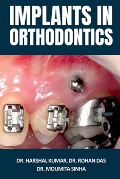 Paperback Implants in Orthodontics Book