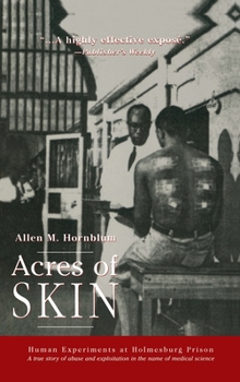 Hardcover Acres of Skin: Human Experiments at Holmesburg Prison Book
