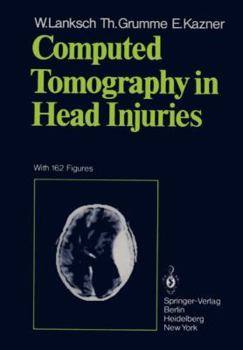 Paperback Computed Tomography in Head Injuries Book