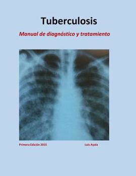 Paperback Tratamiento de Tuberculosis: Manual de diagnóstico y tratamiento [Spanish] Book