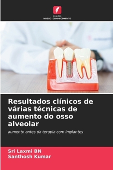 Paperback Resultados clínicos de várias técnicas de aumento do osso alveolar [Portuguese] Book