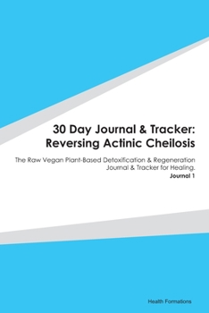 Paperback 30 Day Journal & Tracker: Reversing Actinic Cheilosis: The Raw Vegan Plant-Based Detoxification & Regeneration Journal & Tracker for Healing. Jo Book