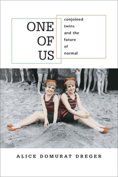 Paperback One of Us: Conjoined Twins and the Future of Normal Book