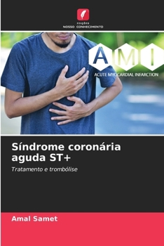 Paperback Síndrome coronária aguda ST+ [Portuguese] Book