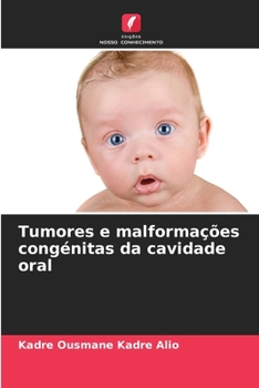 Paperback Tumores e malformações congénitas da cavidade oral [Portuguese] Book