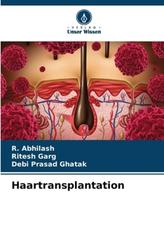 Paperback Haartransplantation [German] Book