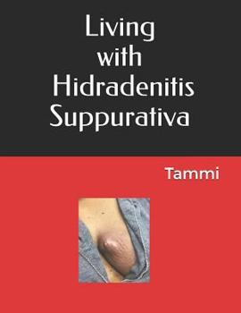 Paperback Living with Hidradenitis Suppurativa Book