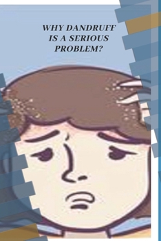 Paperback Head and Shoulders for dandruff Book