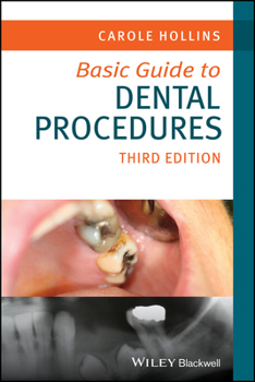 Paperback Basic Guide to Dental Procedures (Basic Guide Dentistry Series) Book