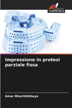 Paperback Impressione in protesi parziale fissa [Italian] Book