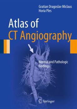 Hardcover Atlas of CT Angiography: Normal and Pathologic Findings Book