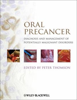 Hardcover Oral Precancer: Diagnosis and Management of Potentially Malignant Disorders Book