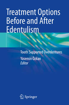 Paperback Treatment Options Before and After Edentulism: Tooth Supported Overdentures Book