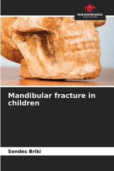 Paperback Mandibular fracture in children Book