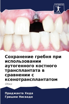 Paperback Сохранение гребня при ис [Russian] Book