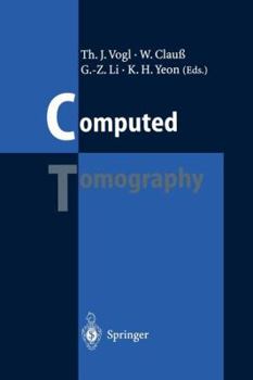 Paperback Computed Tomography: State of the Art and Future Applications Book