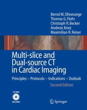 Hardcover Multi-Slice and Dual-Source CT in Cardiac Imaging: Principles - Protocols - Indications - Outlook [With CDROM] Book