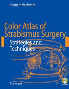 Hardcover Color Atlas of Strabismus Surgery: Strategies and Techniques [With DVD] Book