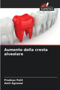 Paperback Aumento della cresta alveolare [Italian] Book