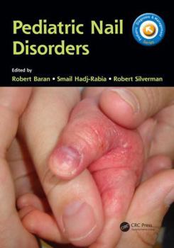 Paperback Pediatric Nail Disorders Book