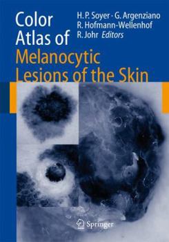 Paperback Color Atlas of Melanocytic Lesions of the Skin Book