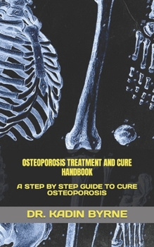 Paperback Osteoporosis Treatment and Cure Handbook: A Step by Step Guide to Cure Osteoporosis Book