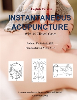 Paperback Instantaneous Acupuncture: With 35 Clinical Cases Book