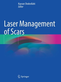 Paperback Laser Management of Scars Book