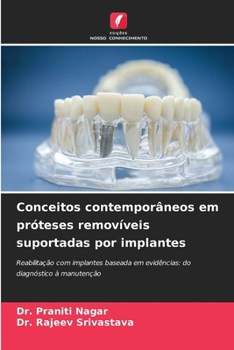 Conceitos contemporâneos em próteses removíveis suportadas por implantes (Portuguese Edition)